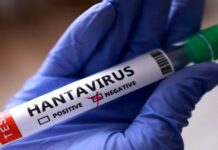 Min-Salud confirmó tres fallecidos por Hantavirus en Anzoátegui