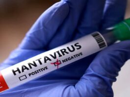 Min-Salud confirmó tres fallecidos por Hantavirus en Anzoátegui