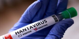 Min-Salud confirmó tres fallecidos por Hantavirus en Anzoátegui