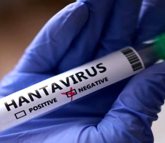 Min-Salud confirmó tres fallecidos por Hantavirus en Anzoátegui